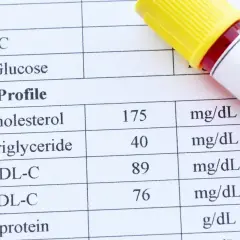 Wynik lipidogramu: cholesterol 175, trójglicerydy 40. Co to są trójglicerydy? To tłuszcze we krwi.