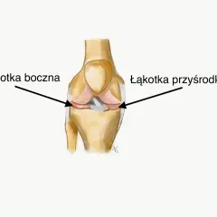 Anatomia kolana: strzałka wskazuje łąkotkę boczną, a druga łąkotkę przyśrodkową.