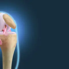 Anatomia kolana z widocznymi więzadłami Cooper'a, stabilizującymi staw.