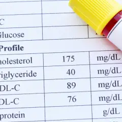 Wynik badania lipidów we krwi: cholesterol 175, trójglicerydy 40, HDL-C 89, LDL-C 76 mg/dL. Obok probówka z krwią.