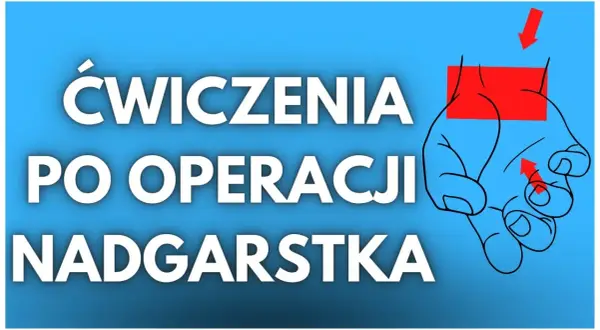 Jakie ćwiczenia po zabiegu cieśni nadgarstka pomogą w szybkiej rehabilitacji