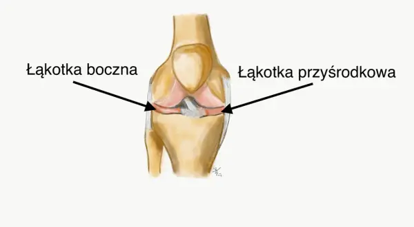 Anatomia kolana: strzałka wskazuje łąkotkę boczną, a druga łąkotkę przyśrodkową.