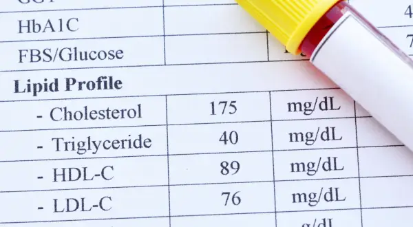 Wynik badania lipidów we krwi: cholesterol 175, trójglicerydy 40, HDL-C 89, LDL-C 76 mg/dL. Obok probówka z krwią.