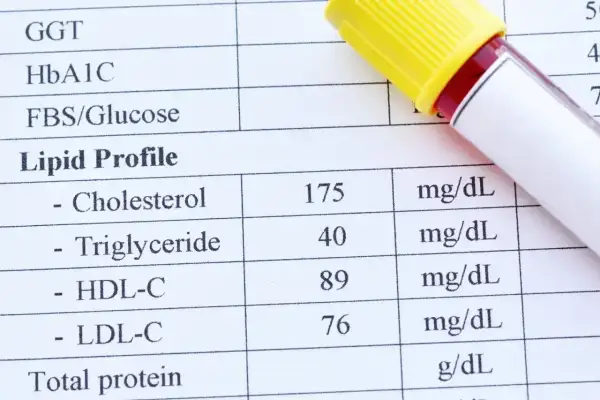 Wynik lipidogramu: cholesterol 175, trójglicerydy 40. Co to są trójglicerydy? To tłuszcze we krwi.