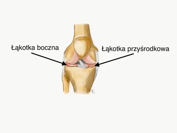 Anatomia kolana: strzałka wskazuje łąkotkę boczną, a druga łąkotkę przyśrodkową.